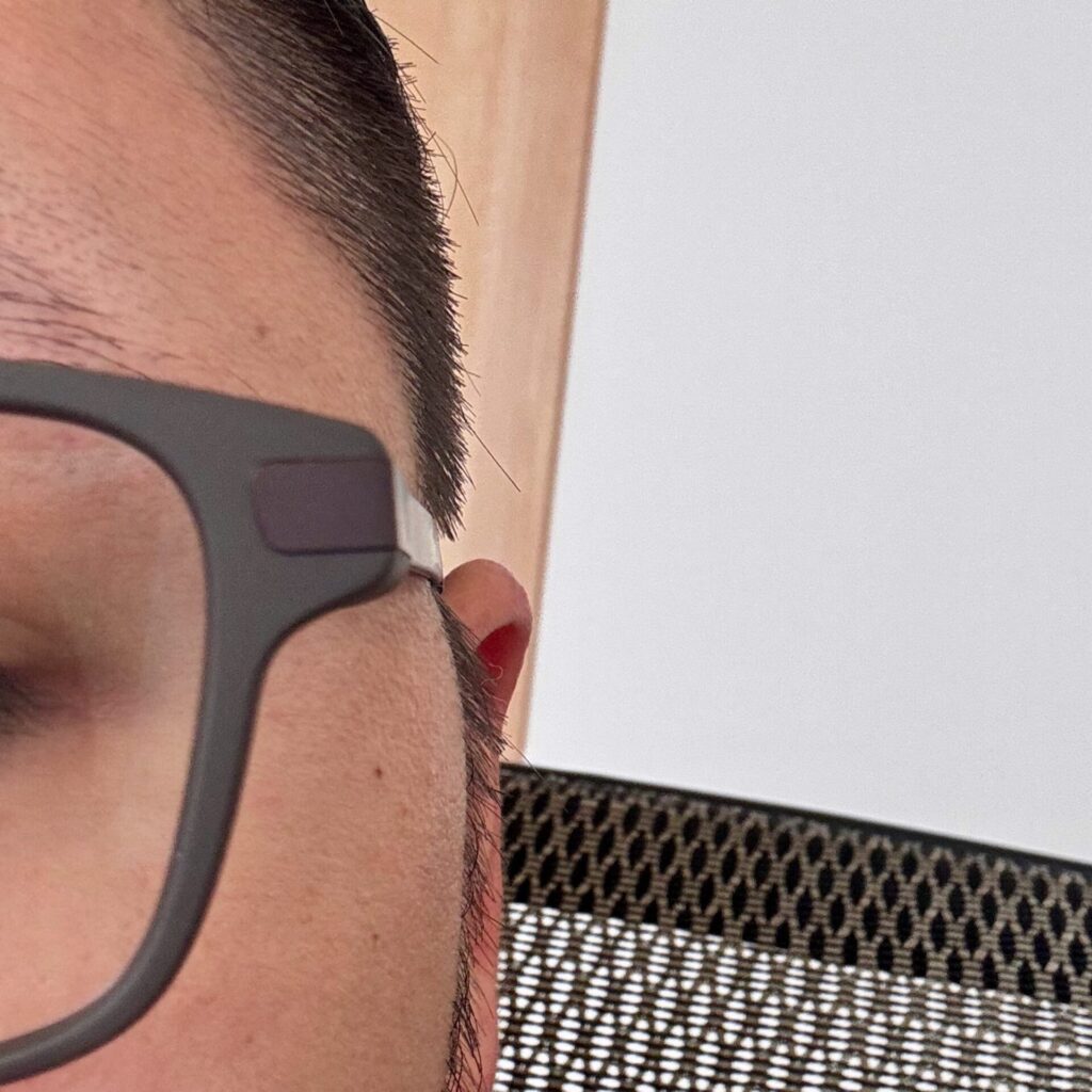 EvenG2を掛けた顔のテンプル付近。側圧で顔の表面が押し込まれている